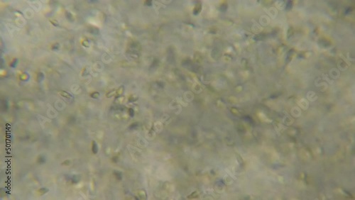 Moving Human Sperm Under Phase Contrast Microscope. Sperm (Spermatozoa) Viewed Under Microscope. Close Up Showing Spermatozoon. Video Human Semen. Macro Closeup. Medical Science Laboratory. photo