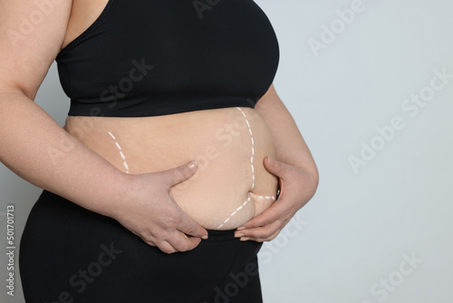 Closeup view of obese woman with marks on body against light background, space for text. Weight loss surgery photo