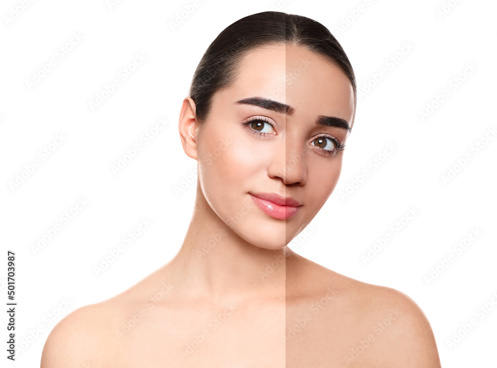 Collage with photos of beautiful young woman before and after indoor tanning on white background Collage with photos of beautiful young woman before and after indoor tanning on white background
