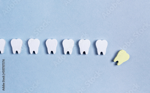 Teeth loss. Sick fallen tooth with cavity among healthy ones. Bad eating habits, poor oral hygiene, gum diseases. High quality photo