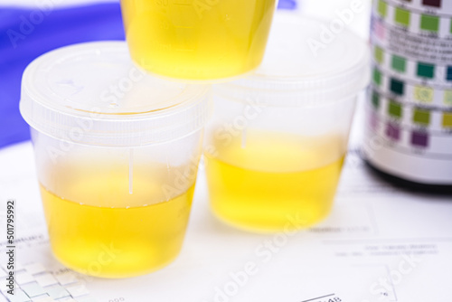 urine vial in laboratory, toxicology or routine examination, vials with urine for laboratory examination photo