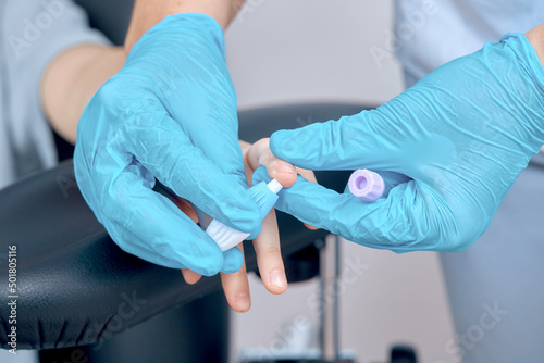 the process of taking blood from a finger for analysis