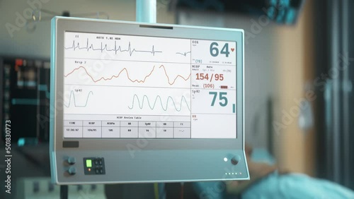 Medical equipment is observing the vital health signs of the emergency patient. Medical equipment monitoring the vital signs. Medical equipment identifies a quick decline of the vital health signs. photo