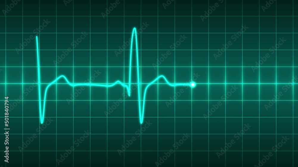 Healthy heartbeat animation. Pulse trace green line on dark green grid background. Seamlessly looping animation. Healthy heartbeat animation. Pulse trace green line on dark green grid background. Seamlessly looping animation.