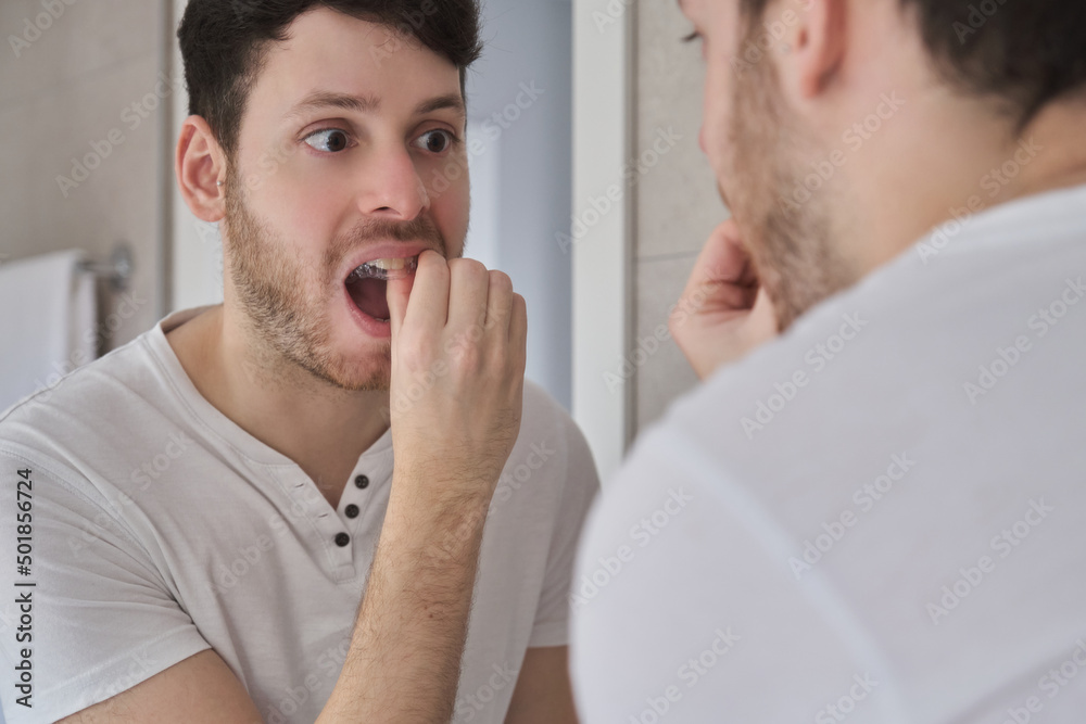 Close up of young latin man removing invisible braces aligner in front of the mirror. Mobile orthodontic appliance for dental correction. Close up of young latin man removing invisible braces aligner in front of the mirror. Mobile orthodontic appliance for dental correction.