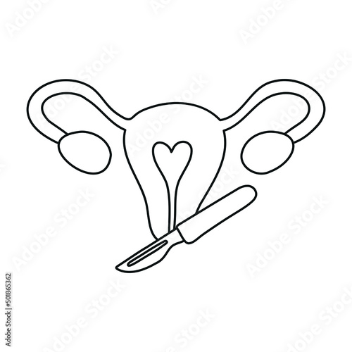 Gynecological surgery, problem with reproductive system. Gynecology. Uterine, ovaries and scalpel. 