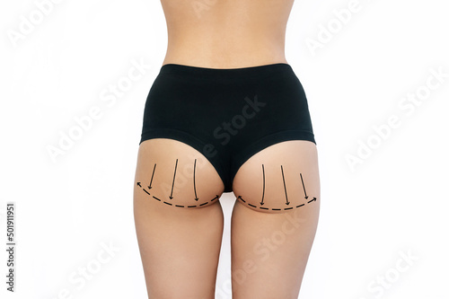 Cropped shot of a young woman with marks for liposuction or plastic surgery on her body isolated on a white background. Overweight, flabby skin. Excess weight on the buttocks photo