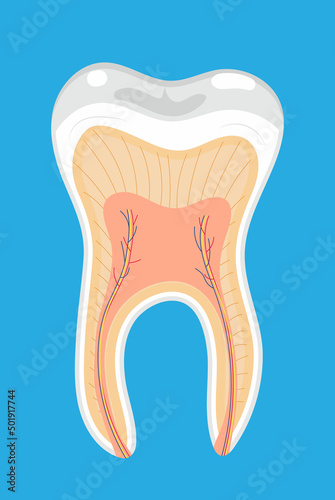 Caries, tartar or tooth cyst treatment icon vector on the blue background. Removal tooth symbol. Problem of pulpitis, periostitis, alveolitis.