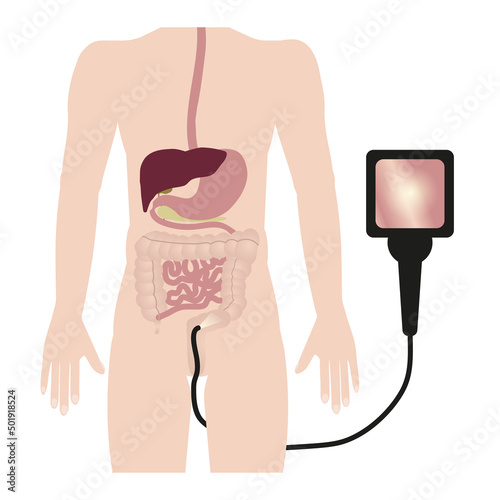 Colonoscopy, internal organs, human digestive system, schematic image
