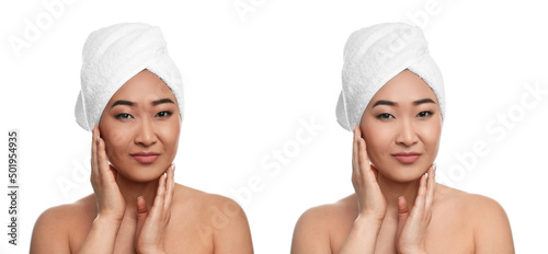Collage with photos of beautiful Asian woman before and after indoor tanning on white background. Banner design