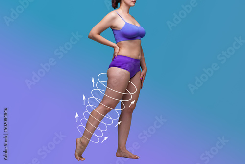 Leg liposuction, fat and cellulite removal concept, overweight female body with painted surgical lines and arrows