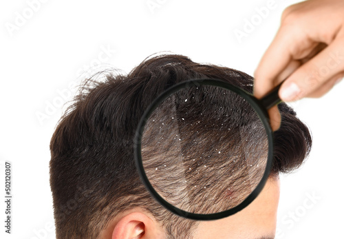 Looking at young man's hair through magnifier on white background. Problem of dandruff