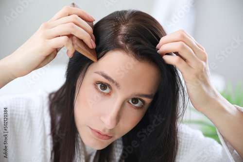 Young woman with problem of dandruff at home