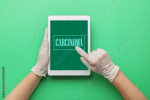 Hands of doctor holding tablet computer with word CARCINOMA on screen against green background, top view