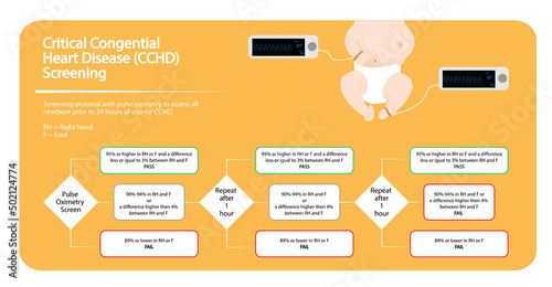 Critical congenital heart defects (CCHD) screening infographic. Newborn pulse oximetry monitoirng protocol to evaluate CCHD.  photo