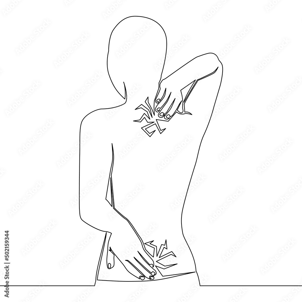 Continuous line drawing Woman experiencing pain in the back concept Continuous line drawing Woman experiencing pain in the back concept