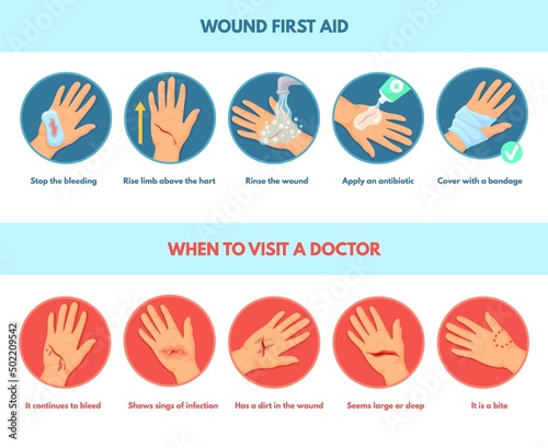 Aid skin wound. First aids stop bleeding, infographic types emergency treatment damaged hands cut infected injury, steps medical dressing, pain injuries after accident, neat vector