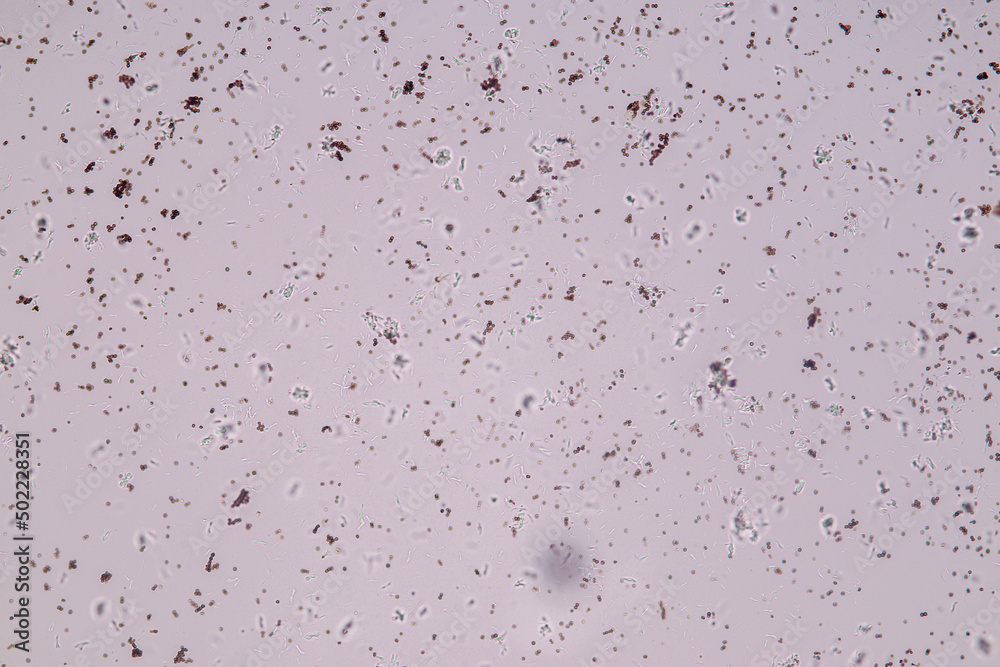 Slime molds, as a group, are polyphyletic under the microscope for education.
Slime molds, as a group, are polyphyletic under the microscope for education.