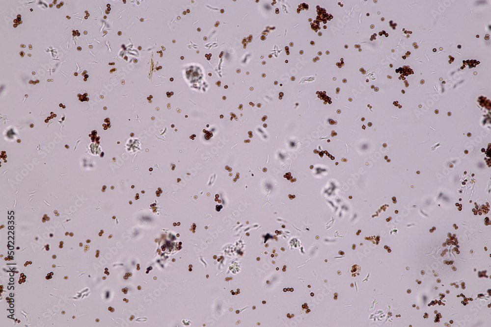 Slime molds, as a group, are polyphyletic under the microscope for education.
Slime molds, as a group, are polyphyletic under the microscope for education.