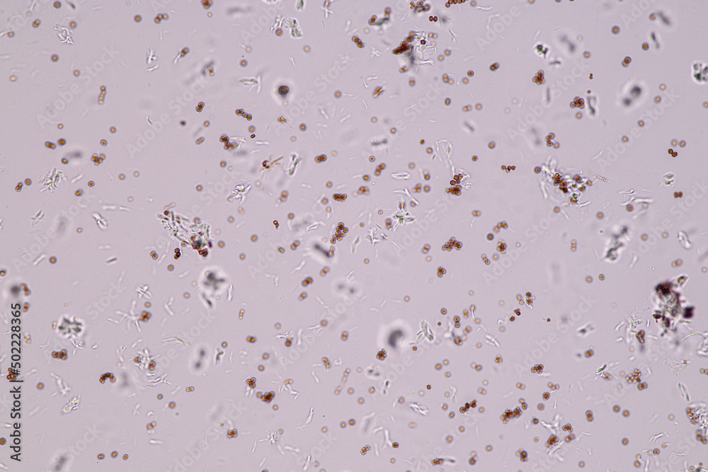 Slime molds, as a group, are polyphyletic under the microscope for education.
Slime molds, as a group, are polyphyletic under the microscope for education.