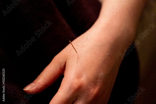 A thin acupuncture needle placed between index finger and thumb, put in place by an acupuncturist. This alternative medicine treatment is used for healing, relaxing, stimulation and stress relief.
