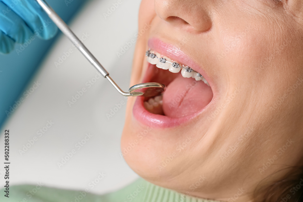 Obraz premium Woman with dental braces visiting dentist in clinic, closeup