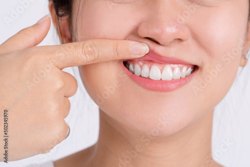 Woman showing her upper gums with her finger, an expression of pain. Dental care and toothache. photo