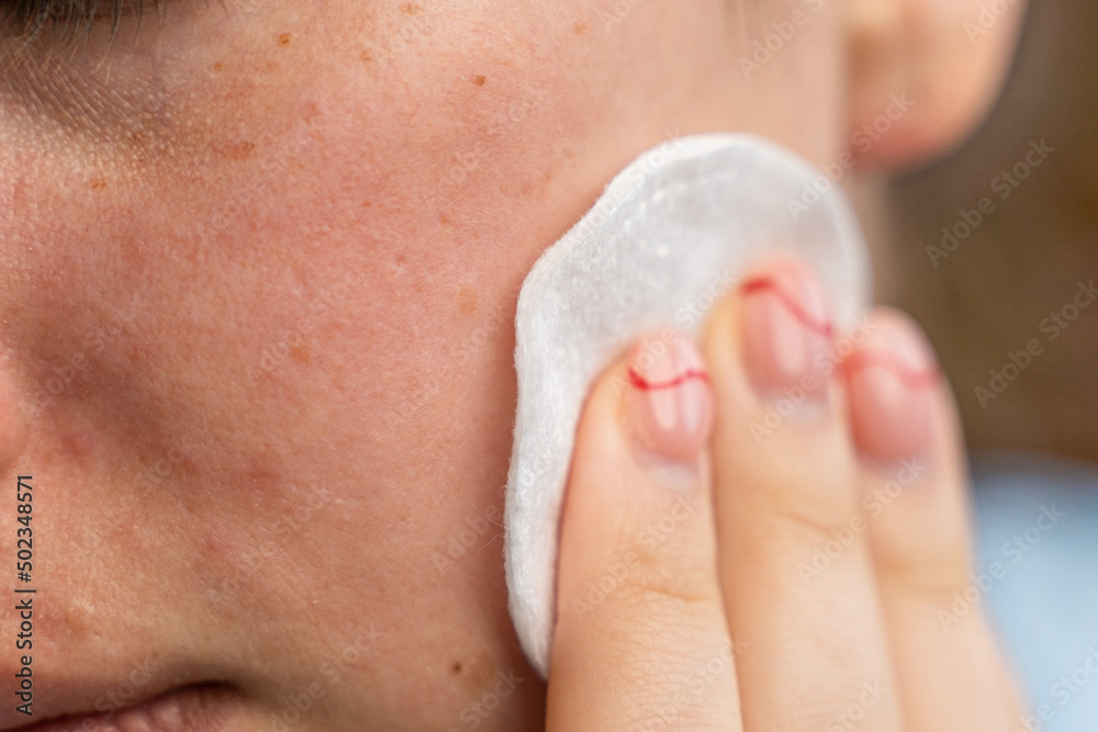 Naklejka premium girl rubbing lotion on her face with a cotton pad