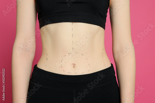 Slim woman with marks on body against pink background, closeup. Weight loss surgery photo