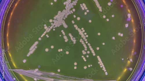 growth of a colony of microorganisms in the microbiological laboratory timelapse photo