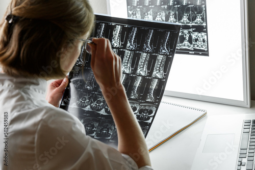 Doctor examining the result of lower spine MRI