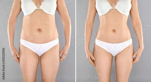 Female belly and hips before and after weight loss, gray background.