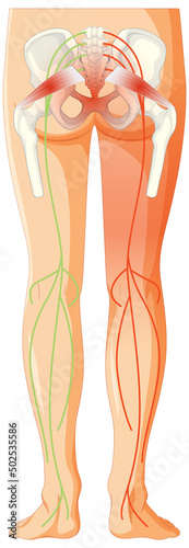 Lower back suffering from ankylosing spondylitis