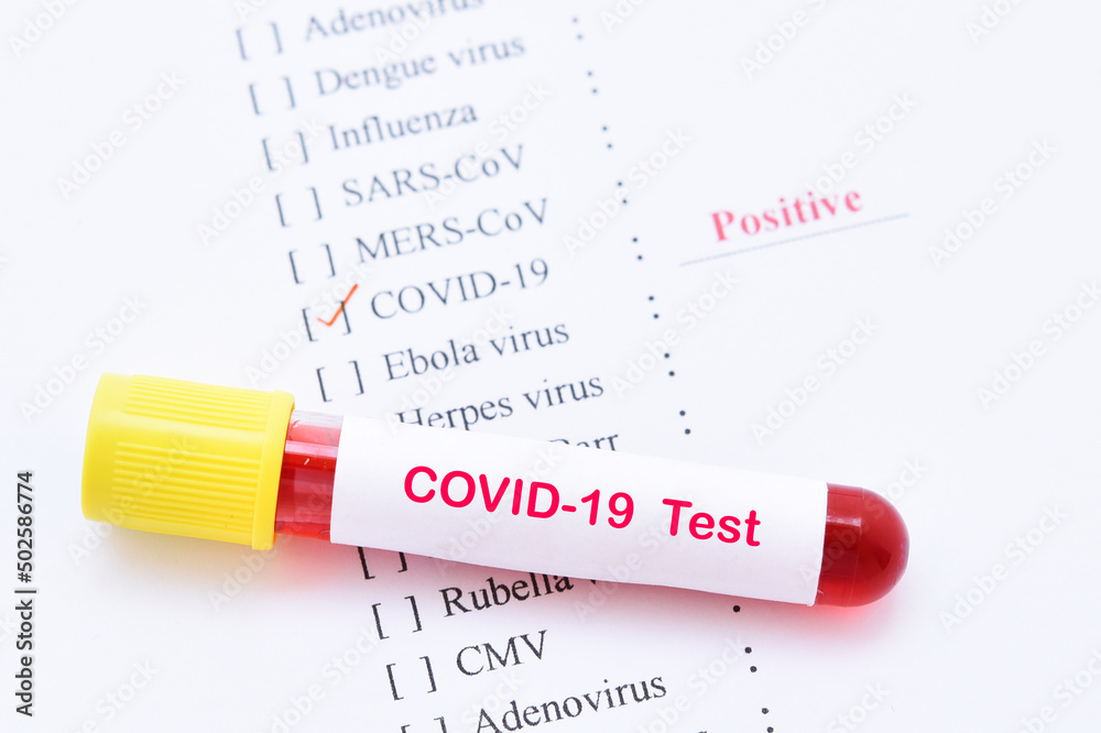 Obraz premium Blood sample tube positive with COVID-19 virus