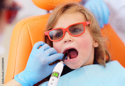 pediatric dentist seals the teeth of a little girl in a pediatric dental clinic. A doctor using dental ultraviolet curing light to polymerize a seal