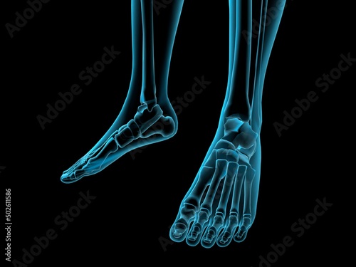 X-ray view of foot bones photo