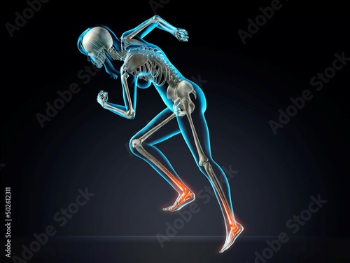 Blue X-ray of woman's skeleton with foot inflammation running on dark blue background photo