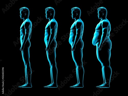 Four men gaining weight, X-ray image