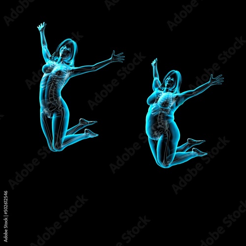 Obese and thin women leaping, X-ray image