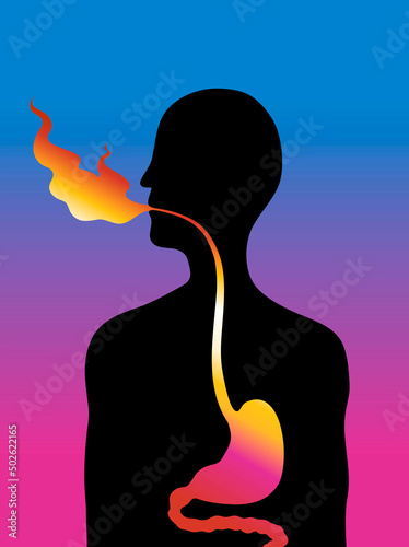 Reflux, illustration photo