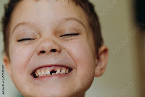 close up portrait of cute caucasian 6 year old boy with lost front tooth