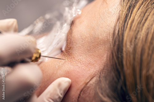 Fotografie Luxury plasma liner treatment