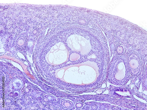 rabbit ovary cross section under the microscope showing tunica albuginea, primordial follicles, primary follicles, secondary follicles, tertiary follicle and cortical stroma - optical microscope x100 photo