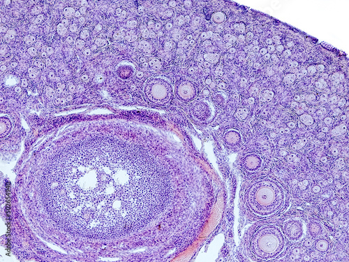 rabbit ovary cross section under the microscope showing tunica albuginea, primordial follicles, primary follicles, secondary follicles and cortical stroma - optical microscope x100 magnification photo