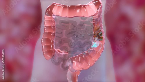 Anatomy of the human digestive system, concept of the intestine, alpha channel, laxative, traitement of constipation, 3d render