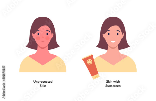 Summer skin care and sunscreen protection concept. Vector flat people illustration. Compare of woman with unprotected skin tan and protected with cream. Design for beauty industry and healthcare