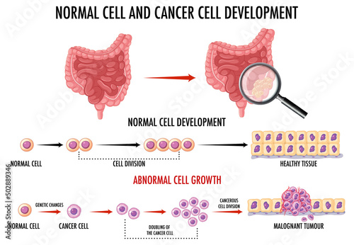 Diagram showing normal and cancer cells