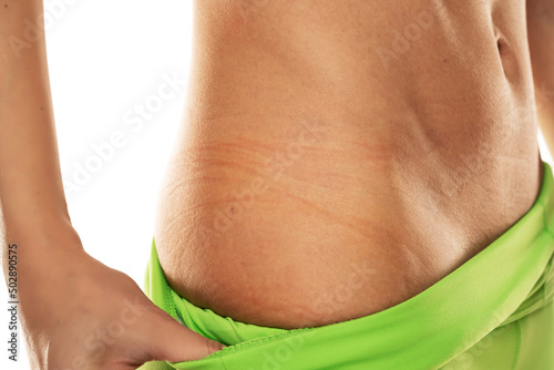 skin indents from underwear on a woman's hips. closeup photo