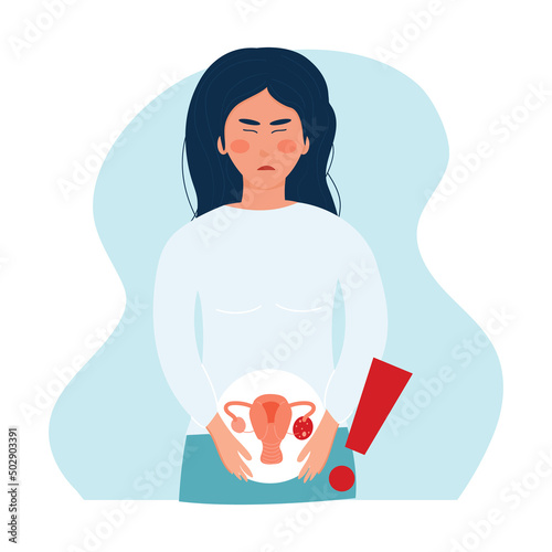 ovarian cyst concept. Woman with acute pain in her groin. Gynecological disease. Adnexal tumor. Inflammation of the female organs. Ovarian rupture. Vector illustration