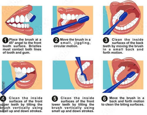 Steps of how to brush your teeth infographic diagram human mouth tooth surface clean inside gum forth motion using toothpaste vector illustration drawing for medical dental clinic education poster
